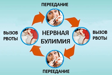 Лечение булимии в Качканаре